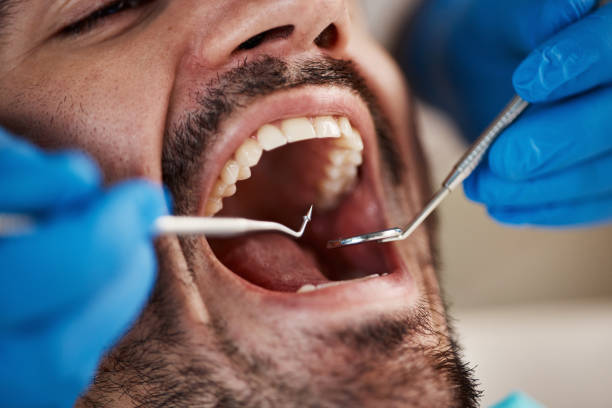 Best Mobile Emergency Dentist in Pleasant Run, OH